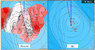 Карта NAVIONICS Platinum+ SonarChart™ Live (52P25XL)